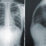 Coronavirus: Should you let your children play with other children?